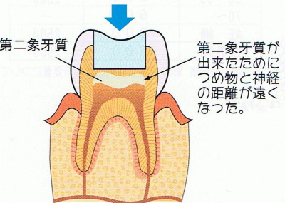 s二次総げ室.jpg