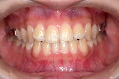sDSC_0493.jpg