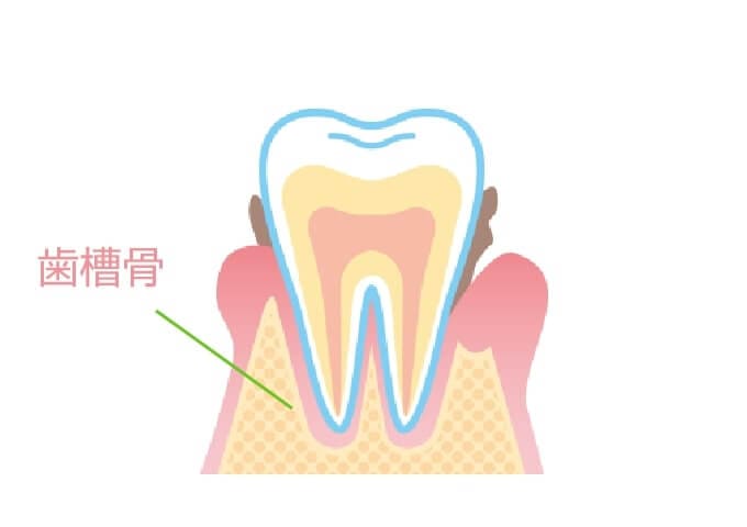 骨が溶ける病気