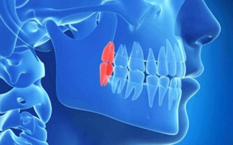  親知らずは診断が重要